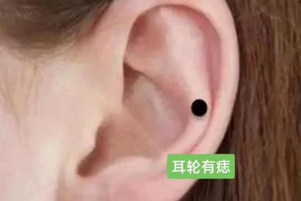 耳垂的秘密：看耳垂的形状与命运之间的神奇联系