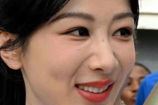 锁骨上有胎记的命运解析：它暗示了什么？