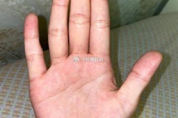 男性没有耳垂的命运解析：耳垂的秘密与人生轨迹的关联
