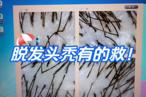 肥头大脸男人的命运：生活的乐趣与挑战