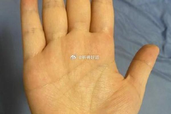 揭秘男人印堂凹陷的命运解析:从面相看人生吉凶! 揭秘男人印堂凹陷的命运解析:从面相看人生吉凶!