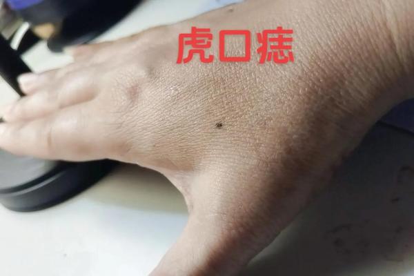 面部多痣的人,命运解密:细数生活中的机遇与挑战 面部多痣的人,命运解密:细数生活中的机遇与挑战