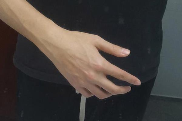 揭开青筋秘密：手上青筋象征着什么命运？
