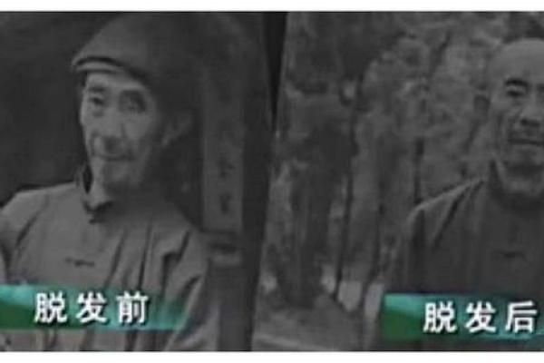 男人没头发是什么命？解读光头背后的秘密与生活智慧