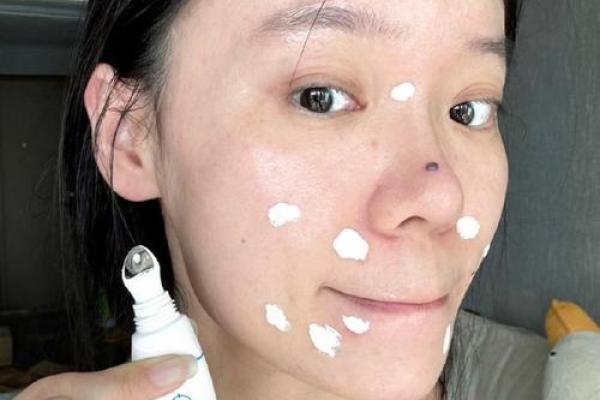 长痘痘的人是什么命？探讨面部痘痘与命运的奥妙！