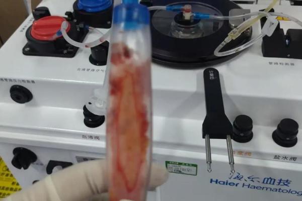 没有血浆的人是什么命：探究血液构成与健康的微妙关系