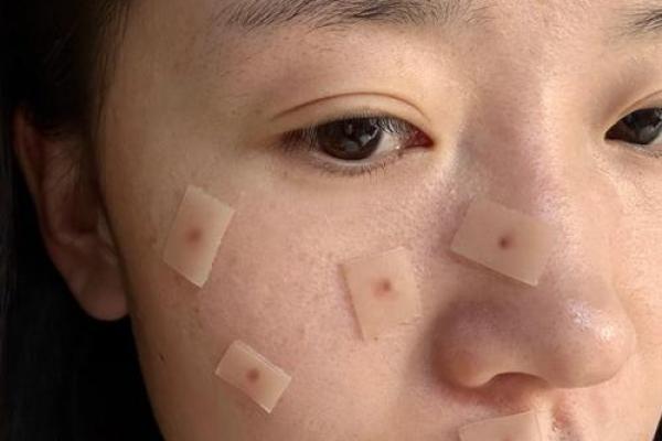 手腕上的痣：命运的隐喻与解读
