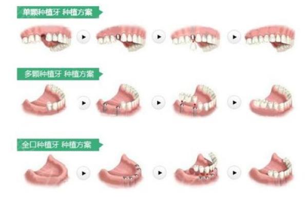 女人的34颗牙齿与命运的奇妙关系