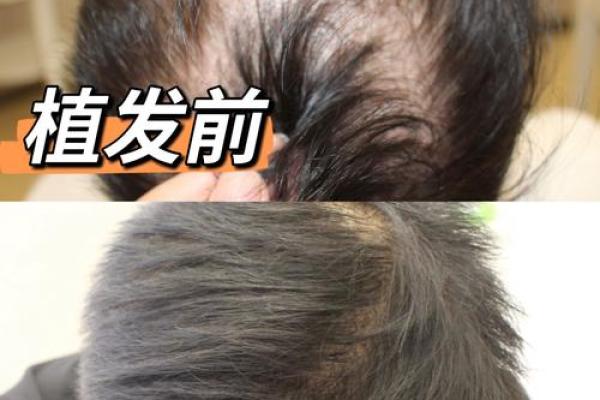 为什么乱睡觉会改命，让生活焕发新生机！