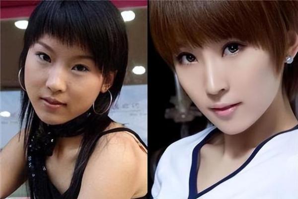 下巴短的人命运分析：性格特点与人生走向探讨