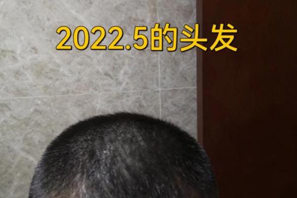 男生头发硬多,命运是否有所不同?探讨头发与性格的关系 男生头发硬多,命运是否有所不同?探讨头发与性格的关系