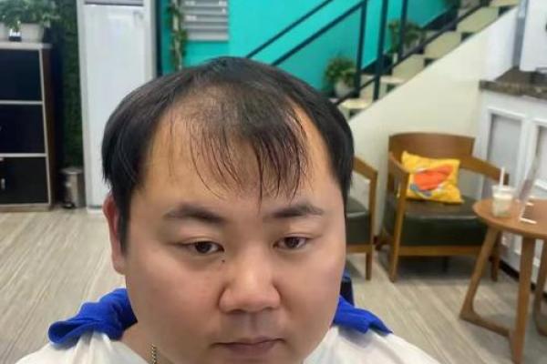 男生头发硬多,命运是否有所不同?探讨头发与性格的关系 男生头发硬多,命运是否有所不同?探讨头发与性格的关系