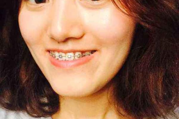 女人牙大露齿，命运如何解读？