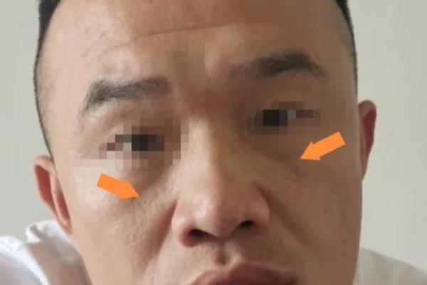 解读额头低的女性命运：智慧与挑战共存的象征