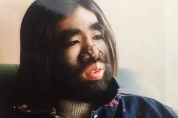 命理解析：揭示天生汗毛旺盛的秘密与原因