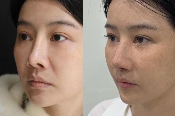 探秘鼻孔大外漏，解读其命理与生活影响！