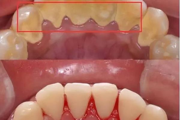 女生的30颗牙与命运：探寻牙齿背后的秘密