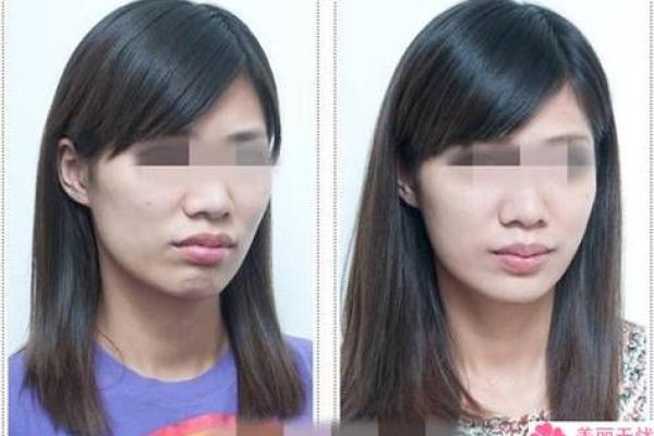 苹果肌饱满的人生运势如何？解析苹果肌背后的面相文化！