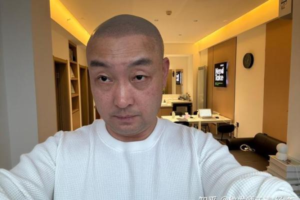 中年秃头的命格与人生哲学探讨：智慧与魅力的别样体现