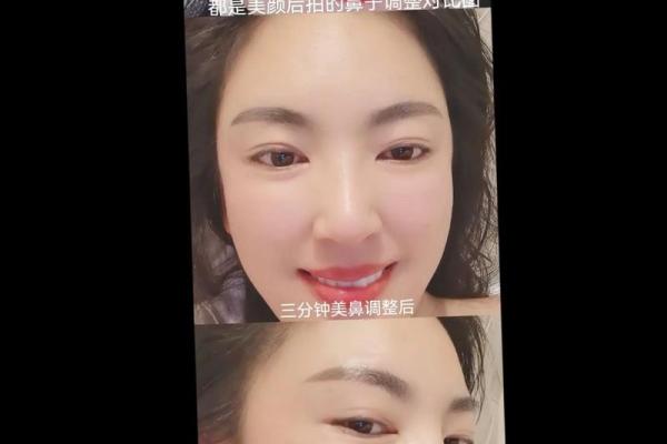 探究鼻梁塌陷是否影响命运：面相学的深奥之处