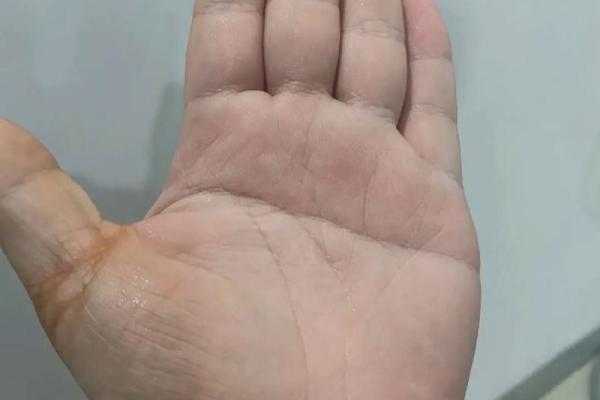 解析儿子双手断掌命运的奥秘与方向