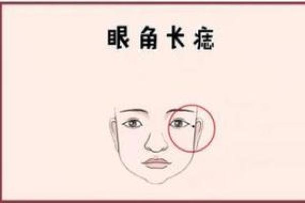 女人眼角有瘊子，揭示了命运与个性的秘密！