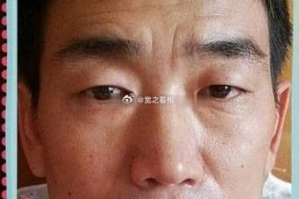 额头横纹解析：从面相看你的人生运势与性格特征