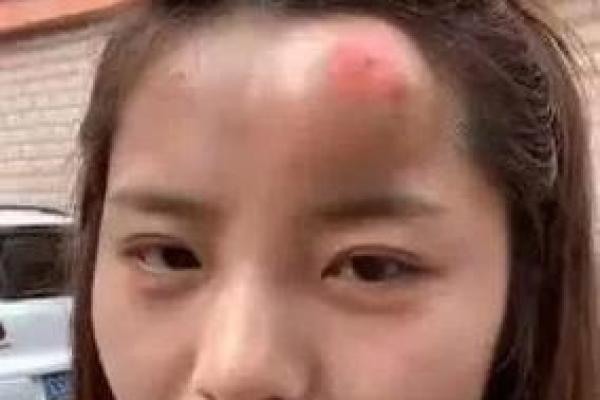 天生头上硬包的命运解析：这些特征你了解吗？