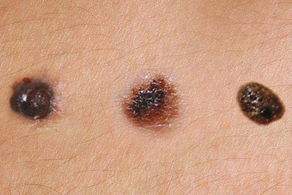 脚指细长的命运：探秘其独特的生命轨迹与性格特征