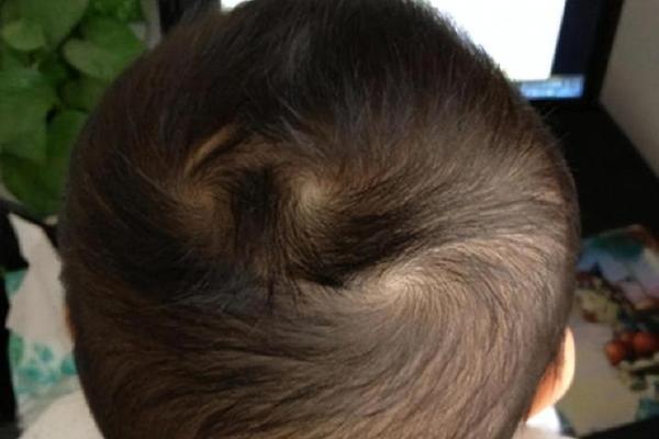 天生曲发，命中注定：探秘发型与性格的奇妙关系