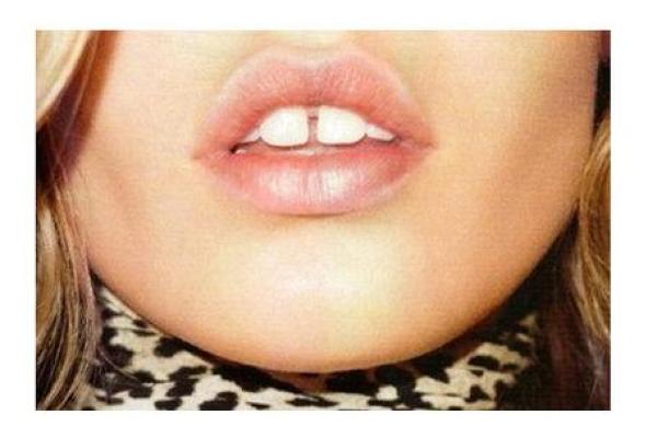 门牙缝宽，命运如何？探索鲜为人知的命理密码