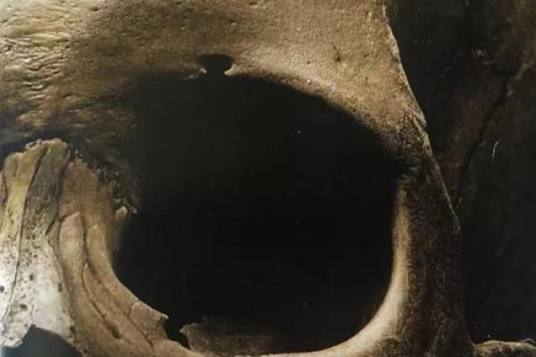 幼年大病不死，命运的微妙转折与人生的深刻启示