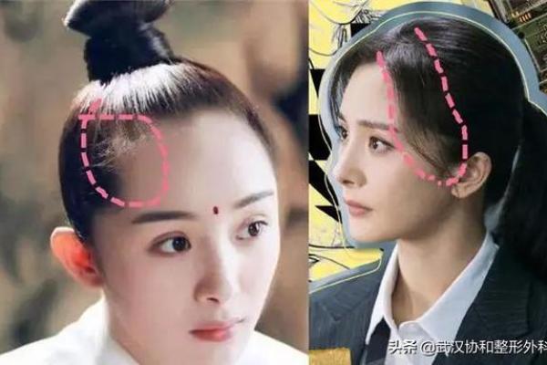 女人发际线高，命运如何解读？