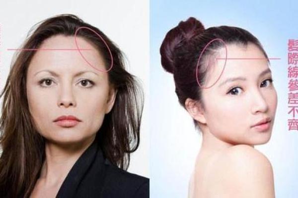 女人发际线高，命运如何解读？