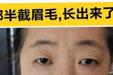 浅谈眉毛与命运：没有长眉毛的人究竟命运如何？