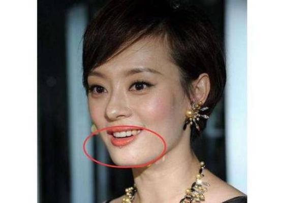 揭秘嘴唇紫黑的命理与性格特征，如何改善！