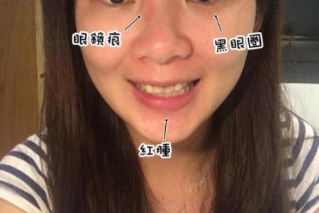 孩子的鼻梁塌陷，是命运的印记还是成长的选择？