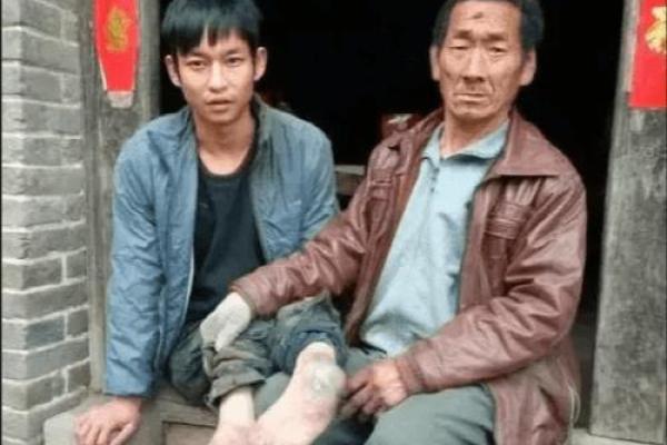 探秘先天残疾与命格：生命中的挑战与机遇