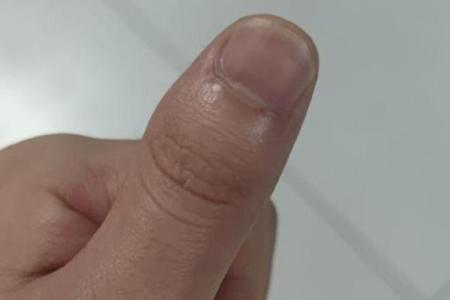 手指月牙偏右：解析其与命理的深刻联系与影响