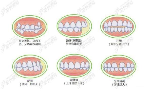 探秘38颗牙齿的命运之谜:从口腔到人生的奥秘解读 探秘38颗牙齿的命运之谜:从口腔到人生的奥秘解读