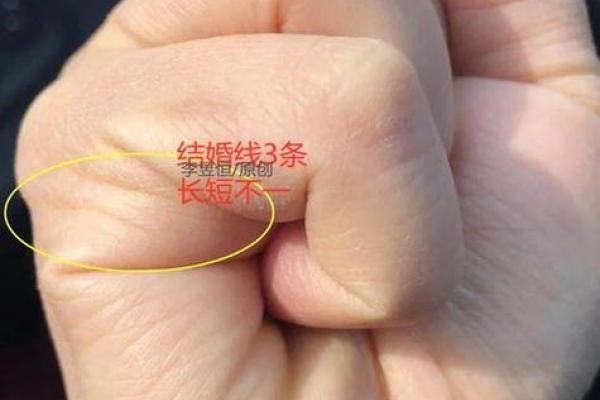 通过手纹解读女性健康密码,揭示潜在疾病隐患 通过手纹解读女性健康密码,揭示潜在疾病隐患