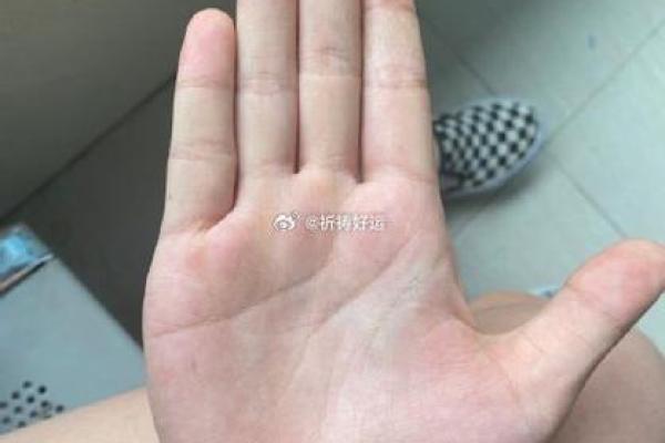 胸前胎记的命运密码:揭示隐藏的性格与人生轨迹 胸前胎记的命运密码:揭示隐藏的性格与人生轨迹