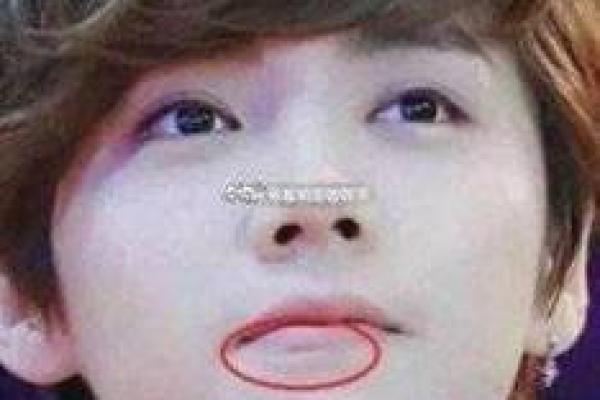 嘴唇下面有疤，是否会影响命运？揭示深层秘密！