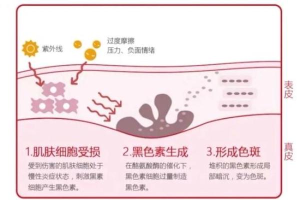 皮肤健康与命运：探索肤色与生命质量的关系
