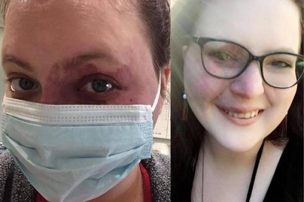 头顶长胎记的人,命运何其不同?探秘胎记的奥秘与缘分 头顶长胎记的人,命运何其不同?探秘胎记的奥秘与缘分