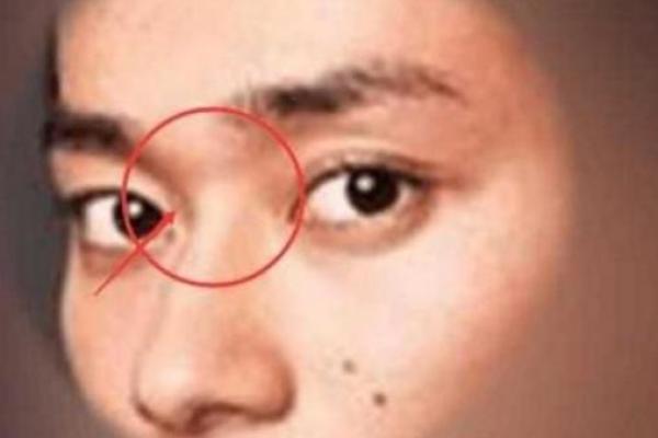 没山根的鼻子命运解析：外貌与命运的奇妙关系