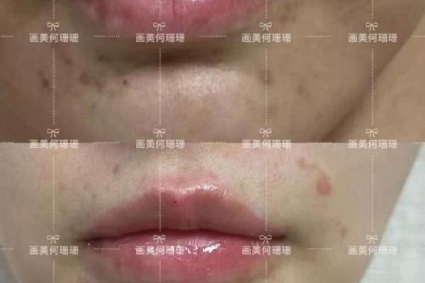 薄唇女孩的命运解析：都是薄唇惹的祸吗？