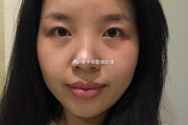 脸部刀疤的命理解析：命运与外在的神秘联系