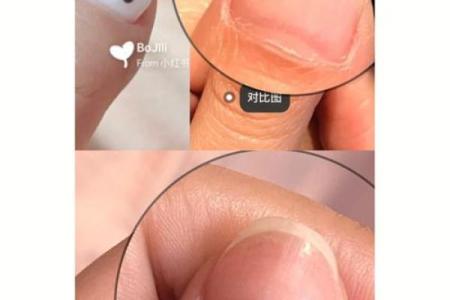 大拇指粗短，命运与性格的秘密探秘！