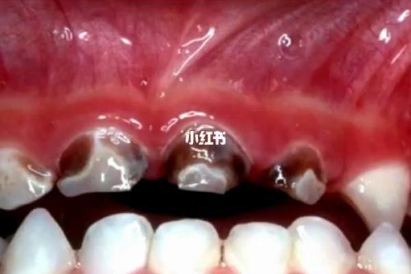 23颗牙齿的命运:牙齿与人生的奇妙关联 23颗牙齿的命运:牙齿与人生的奇妙关联